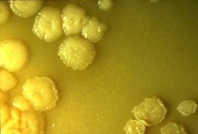 COLONIAS MYCOBACTERIUM PARATUBERCULOSIS.jpg